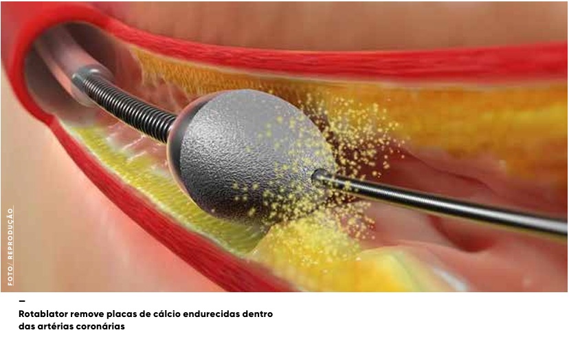 vb ed301 marco 26b 2 2 tecnologia a favor do coracao