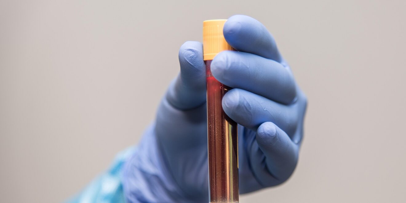 annett klingner blood sample 6200015 1920