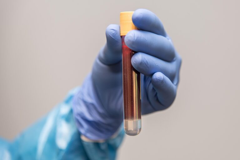 annett klingner blood sample 6200015 1920