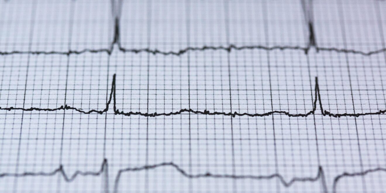 stux ecg 2270728 1920