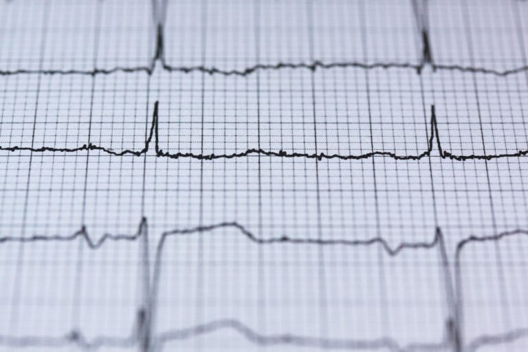 stux ecg 2270728 1920